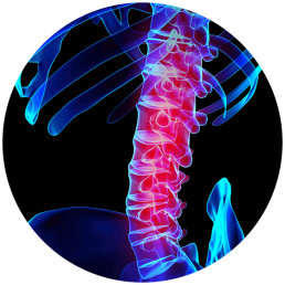 Facet Joint Pain Symptoms & Treatment Options | Houston Spine Dr. Martin | (281) 653-2686 | Houston Spine Surgeon Board Certified | Next Day Appointment