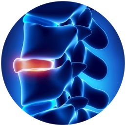Herniated Disc Symptoms & Treatment Options | Houston Spine Dr. Martin | (281) 653-2686 | Houston Spine Surgeon Board Certified | Next Day Appointment