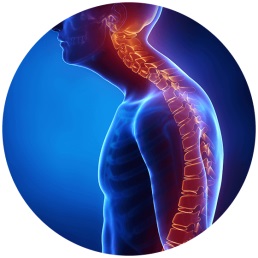 Kyphosis Symptoms & Treatment Options | Houston Spine Dr. Martin | (281) 653-2686 | Houston Spine Surgeon Board Certified | Next Day Appointment
