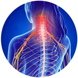 Radiculopathy Symptoms & Treatment | Houston Spine Dr. Martin | (281) 653-2686 | Houston Spine Surgeon Board Certified | Next Day Appointment