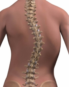 Spinal Deformities Symptoms & Treatment Options