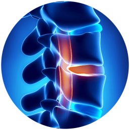 Spinal Stenosis Symptoms & Treatment Options | Houston Spine Dr. Martin | (281) 653-2686 | Houston Spine Surgeon Board Certified | Next Day Appointment