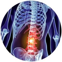 Spondylolisthesis Symptoms & Treatment Options | Houston Spine Dr. Martin | (281) 653-2686 | Houston Spine Surgeon Board Certified | Next Day Appointment