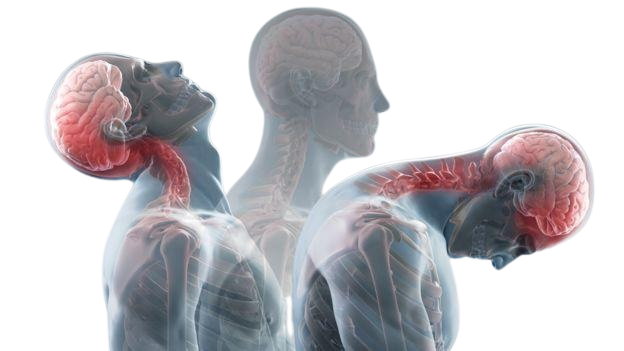 Whiplash Symptoms & Treatment Options | Houston Spine Dr. Martin | (281) 653-2686 | Houston Spine Surgeon Board Certified | Next Day Appointment