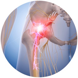 Sciatica Symptoms & Treatment Options | Houston Spine Dr. Martin | (281) 653-2686 | Houston Spine Surgeon Board Certified | Next Day Appointment