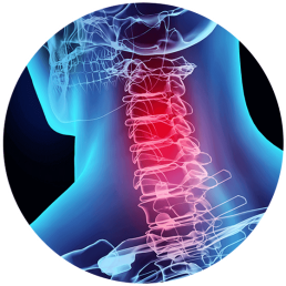 Whiplash Symptoms & Treatment Options | Houston Spine Dr. Martin | (281) 653-2686 | Houston Spine Surgeon Board Certified | Next Day Appointment
