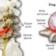 Finding Relief from Degenerative Disc Disease By Expert Spine Surgeon in Houston